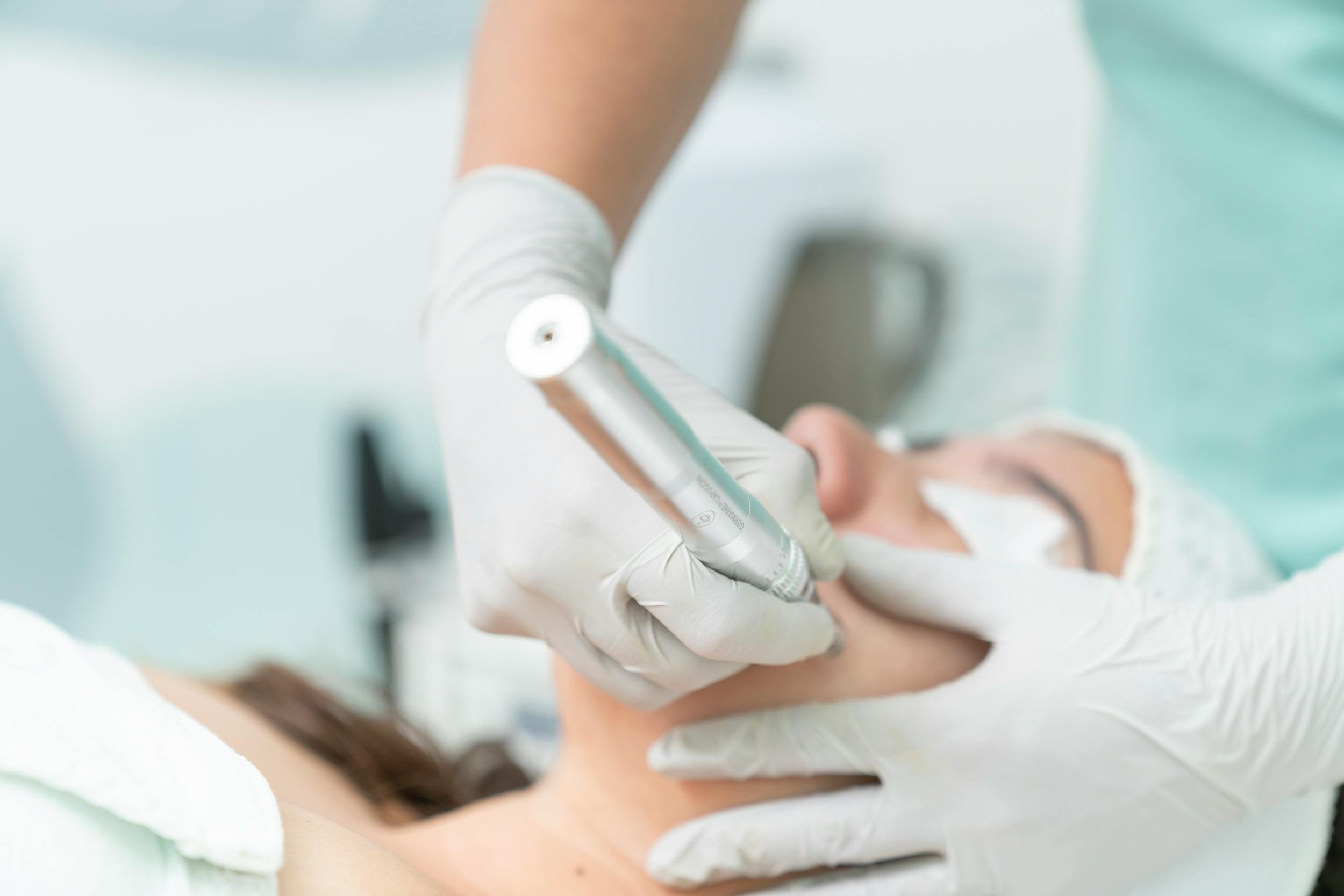 Curs Microneedeling (Dermapen)
